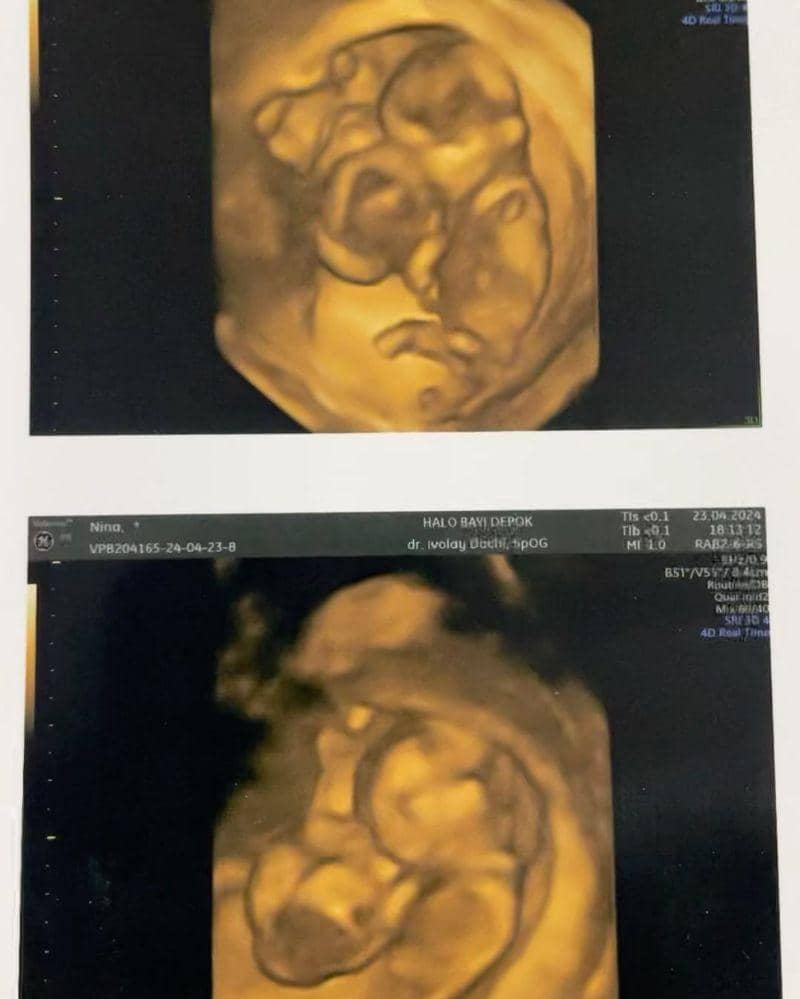 Instagram.com/nina_mpokalpa